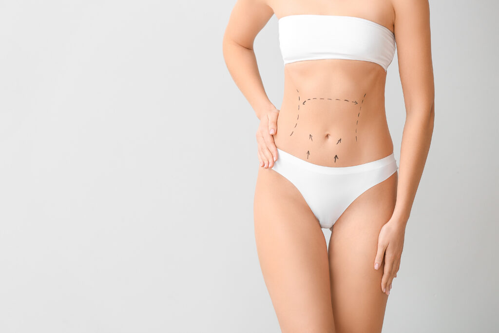 Young woman with marks on her belly against light background. Concept of plastic surgery