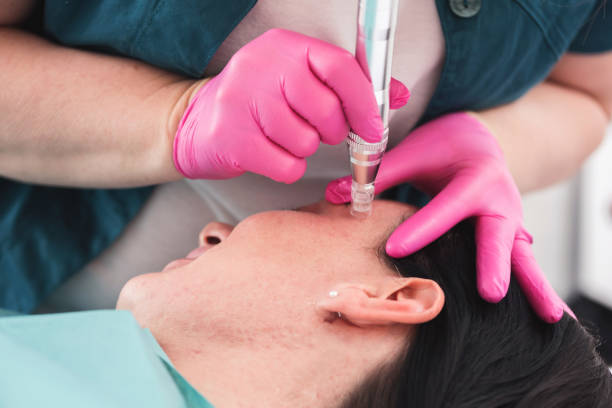 Cosmetologist making dermapen microneedle therapy. Treatment woman at beautician. Concept cosmetology. Treatment of face zone, lifting face rejuvenation. Close up