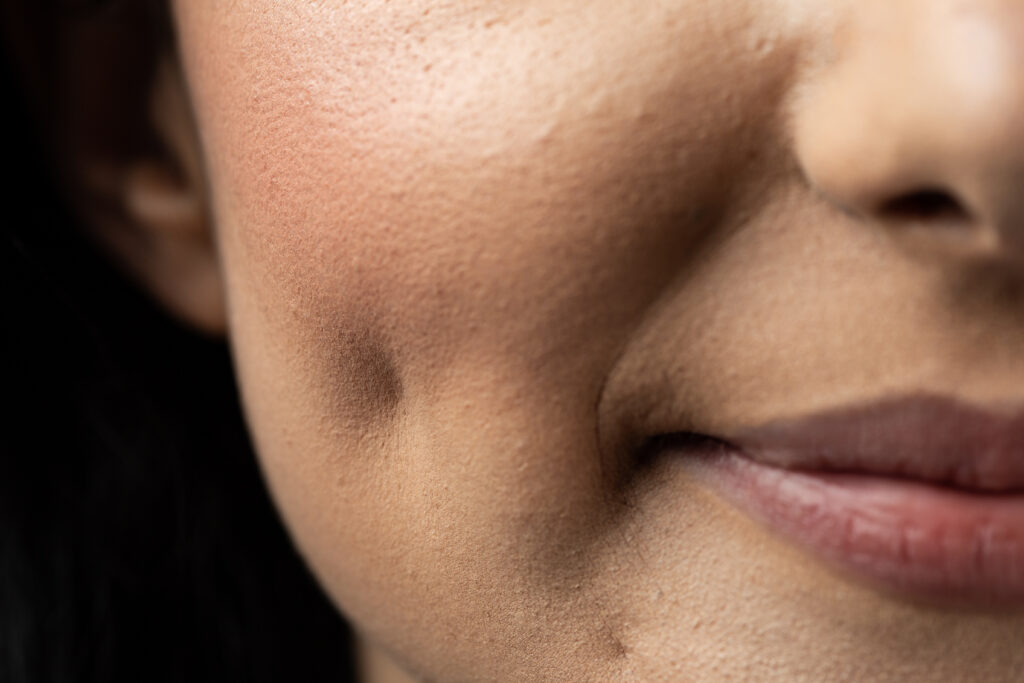 Macro closeup of Caucasian woman smiling having dimples. Beauty concept.