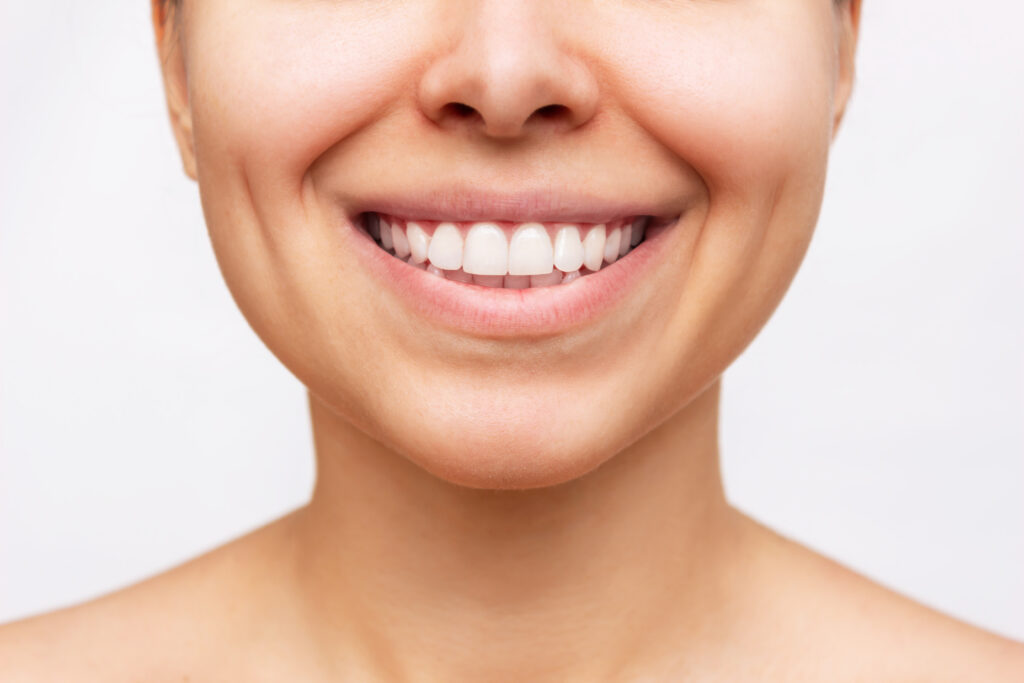 Cropped shot of a young caucasian woman with perfect white even teeth isolated on a white background. Oral hygiene, dental health care. Close-up of beautiful smile. Veneers, teeth whitening. Dentistry